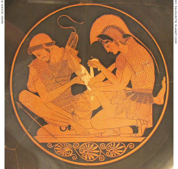 Vase painting of Achilles binding the wound of Patroklos by the Sosias Painter at My Favourite Planet Vase painting of Achilles binding the wound of Patroklos by the Sosias Painter at My Favourite Planet